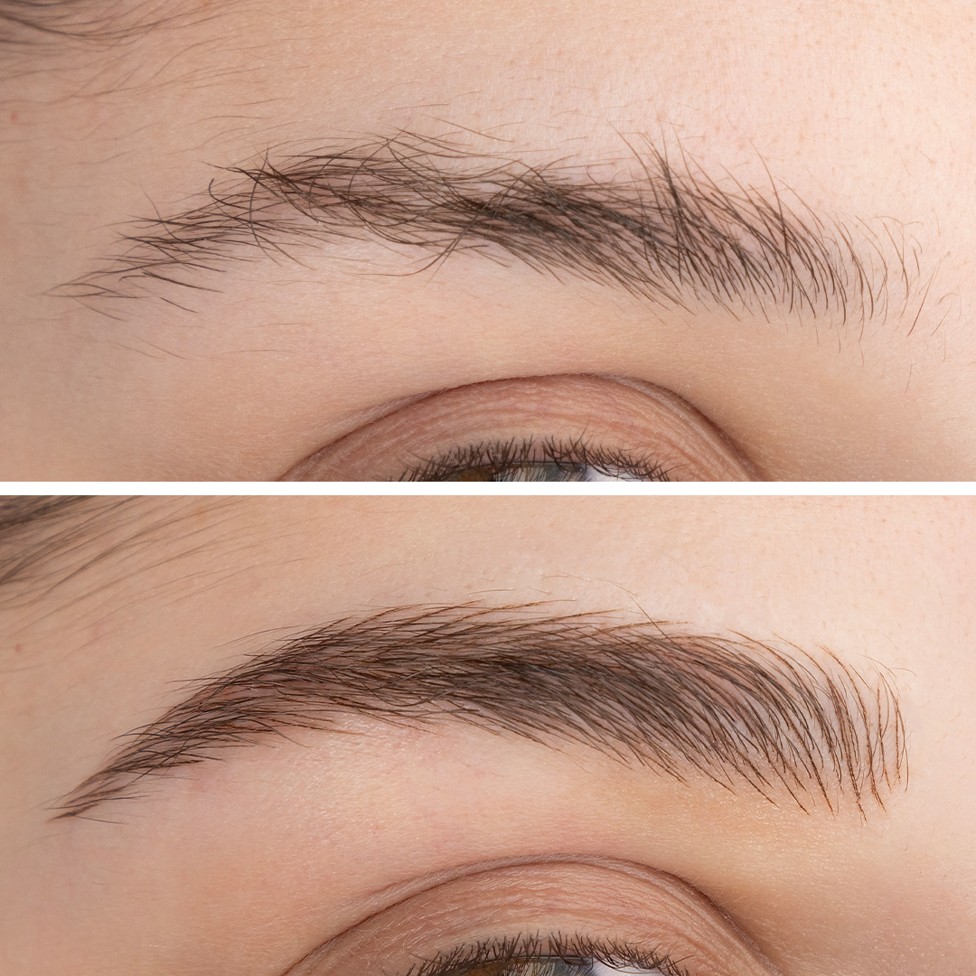 BB Stroke: Before & After