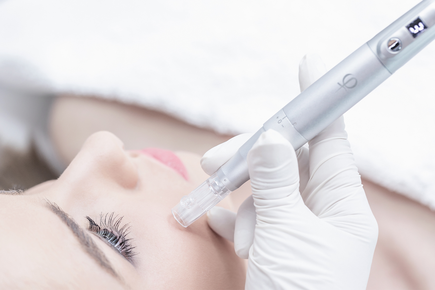 Procedura di microneedling con dermapen Procedura di microneedling con dermapen